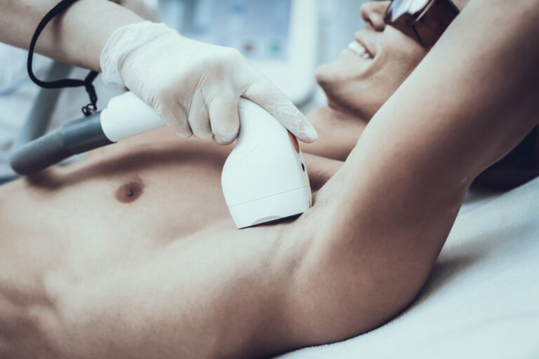 5 Things You Should Know About Laser Hair Removal for Men