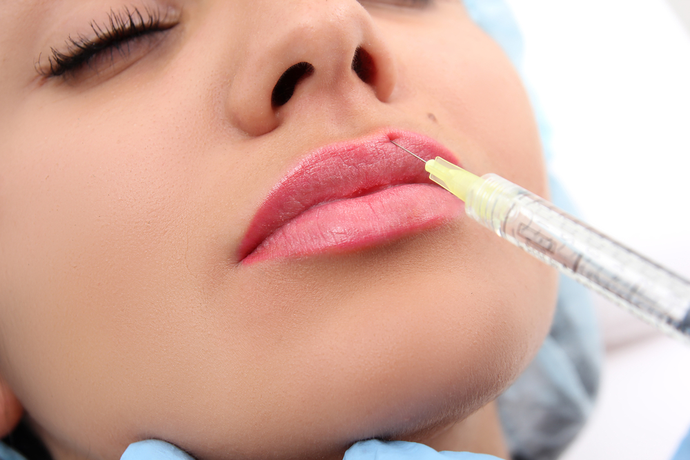 Juvéderm Fillers for Lips: Which Product Is Best? 