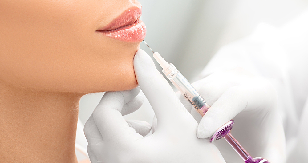 How Long Does Lip Filler Last After Plumping Your Pucker?