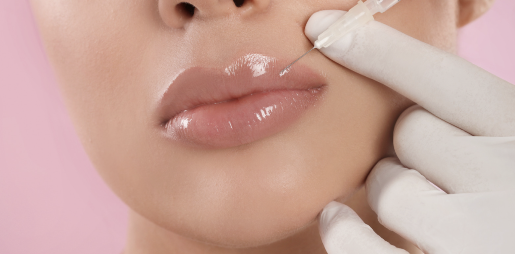 Longer Lasting Lip Fillers in Herndon