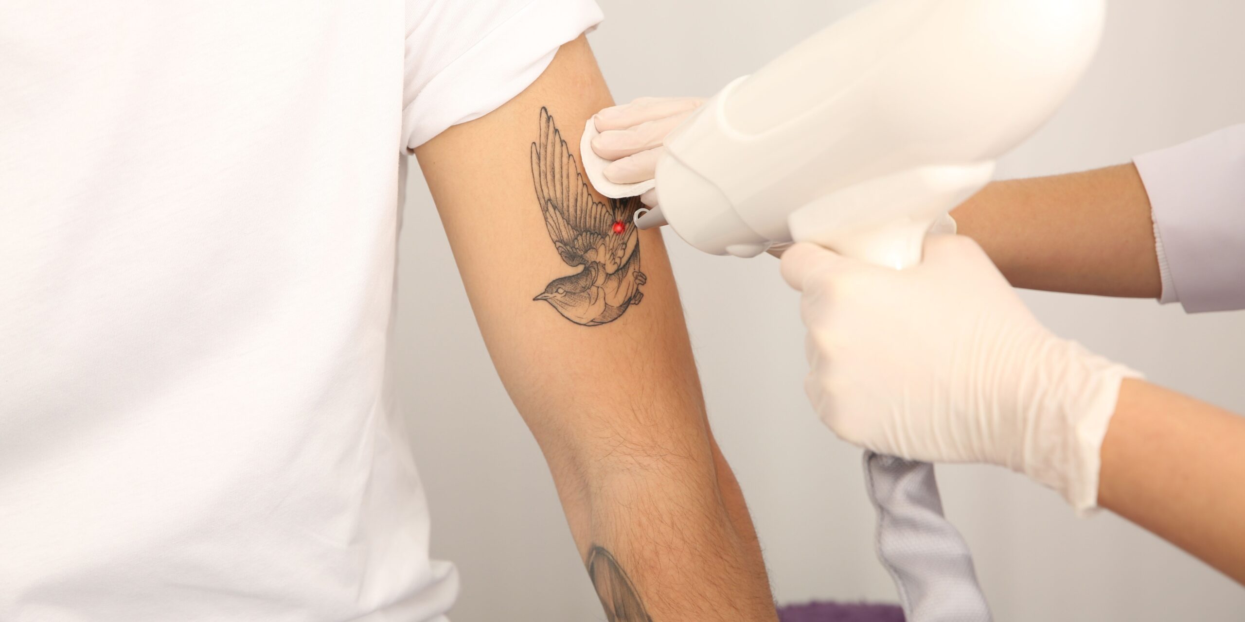 Same-Day Tattoo Removal Cost