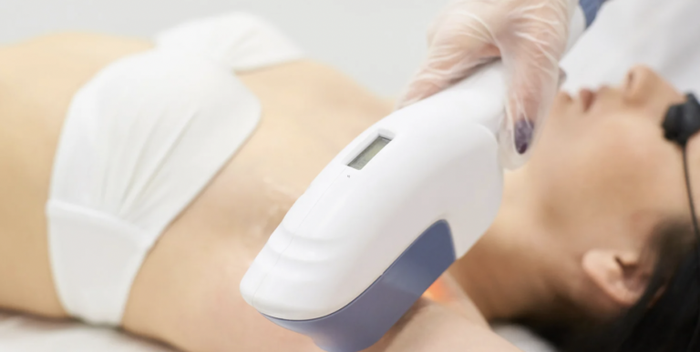 Laser Hair Removal in Loudoun County