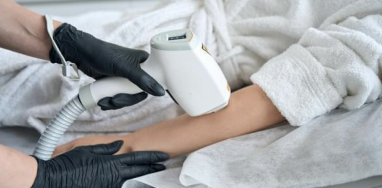 Best Times for Laser Hair Removal Treatments in Northern Virginia