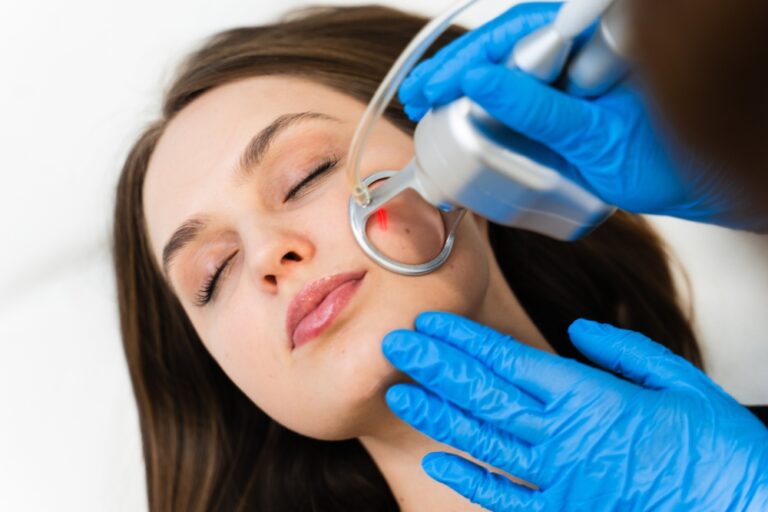 Laser Resurfacing in Reston Virginia