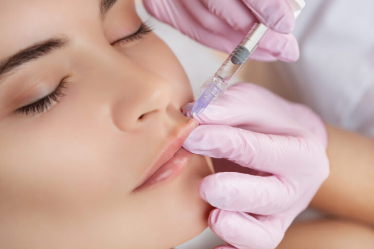 The Secrets to Natural Looking Results From Popular Lip Filler Treatment Near Reston, VA