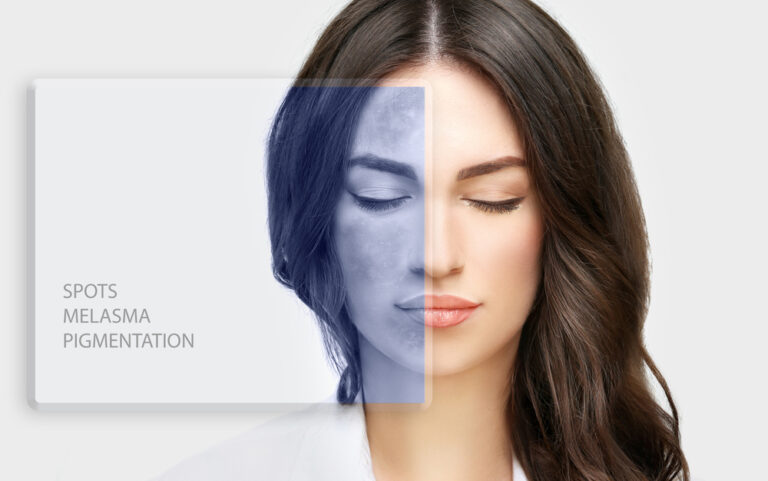 Pico Laser Results: What to Expect in Your First Session in Northern Virginia
