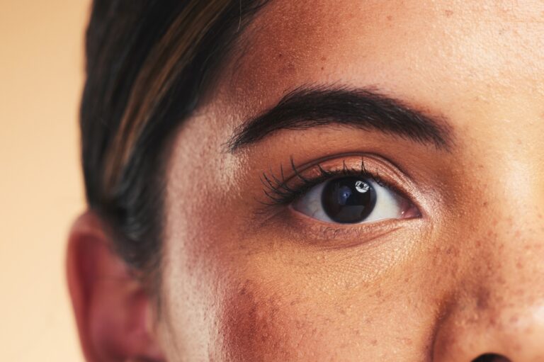 Your Quick Guide on Where to Find Effective Melasma Care Near Fairfax, VA