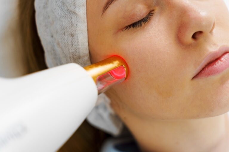 Top 5 Benefits of CO₂ Laser Resurfacing for Youthful Skin