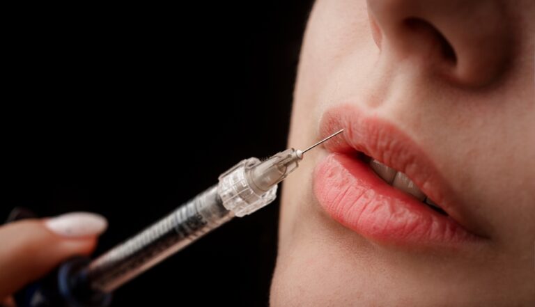3 Reasons Why You Should Get Lip Fillers from a Black Injector Near Ashburn, VA