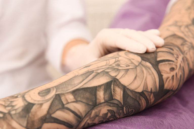 Laser Tattoo Removal Consultation Near Fairfax, Virginia