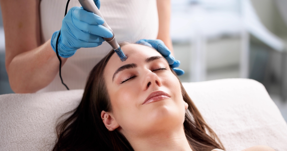 Microneedling Skin Rejuvenation Treatments in Herndon, Virginia