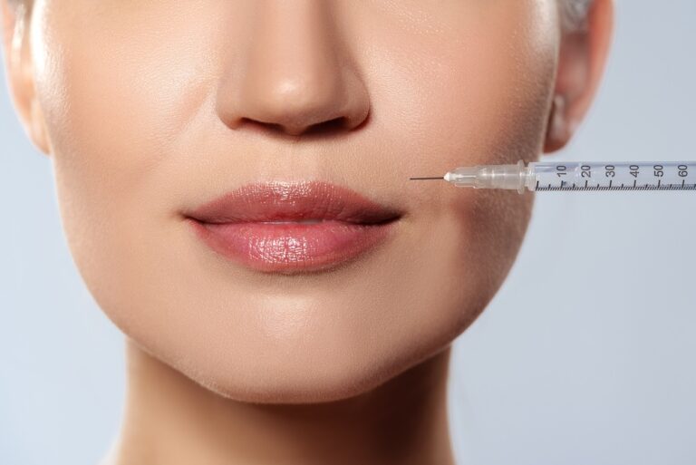 Lip Filler in Northern Virginia: Natural-Looking Results With Hyaluronic Acid Fillers