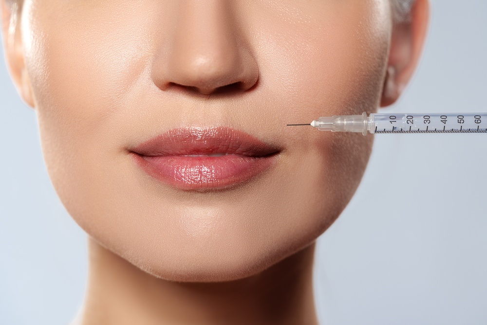 Lip Filler in Northern Virginia: Natural-Looking Results With Hyaluronic Acid Fillers