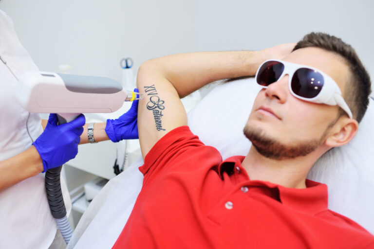 Best Laser Tattoo Removal Clinic Near Arlington, Virginia for Stubborn Ink and Multi Color Tattoos