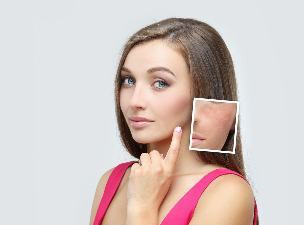 Pico Laser Treatment for Hyperpigmentation Near McLean, Virginia: Cost, Results, and Recovery Time