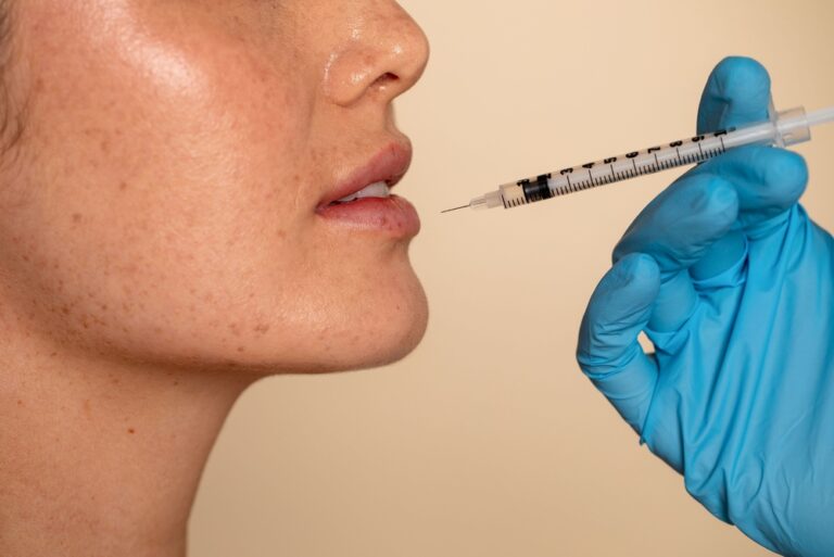 Lip Filler and Under Eye Rejuvenation Near Reston, Virginia