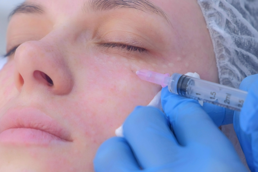 Natural Looking Under Eye Filler Results in Falls Church, VA