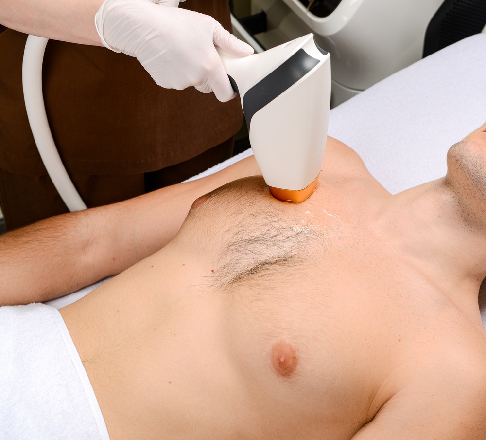 Best Laser Hair Removal Treatments in Ashburn, VA: What Areas Can Be Treated?