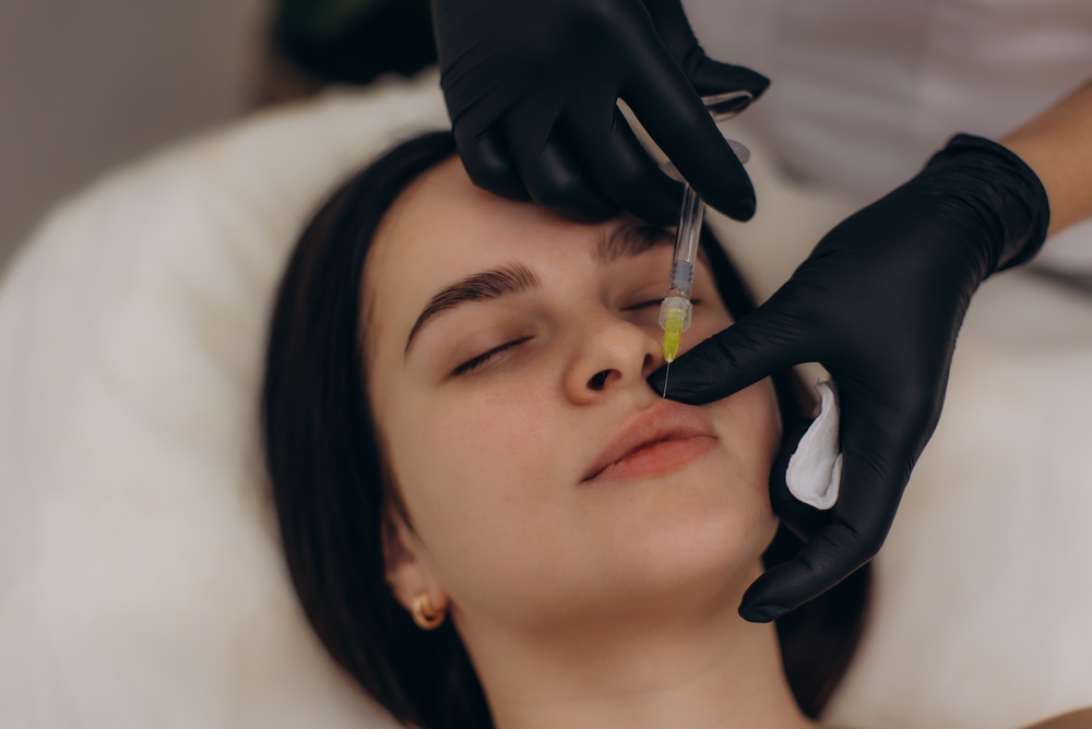 Natural-Looking Lip Filler in Reston, VA